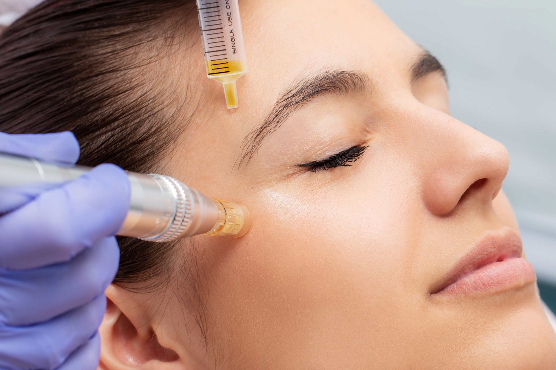 Mesoterapia Facial